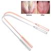 Oral Care Metal Tongue Scraper Bad Breath Treatment Oral Hygiene Maintaining Tongue Cleaner