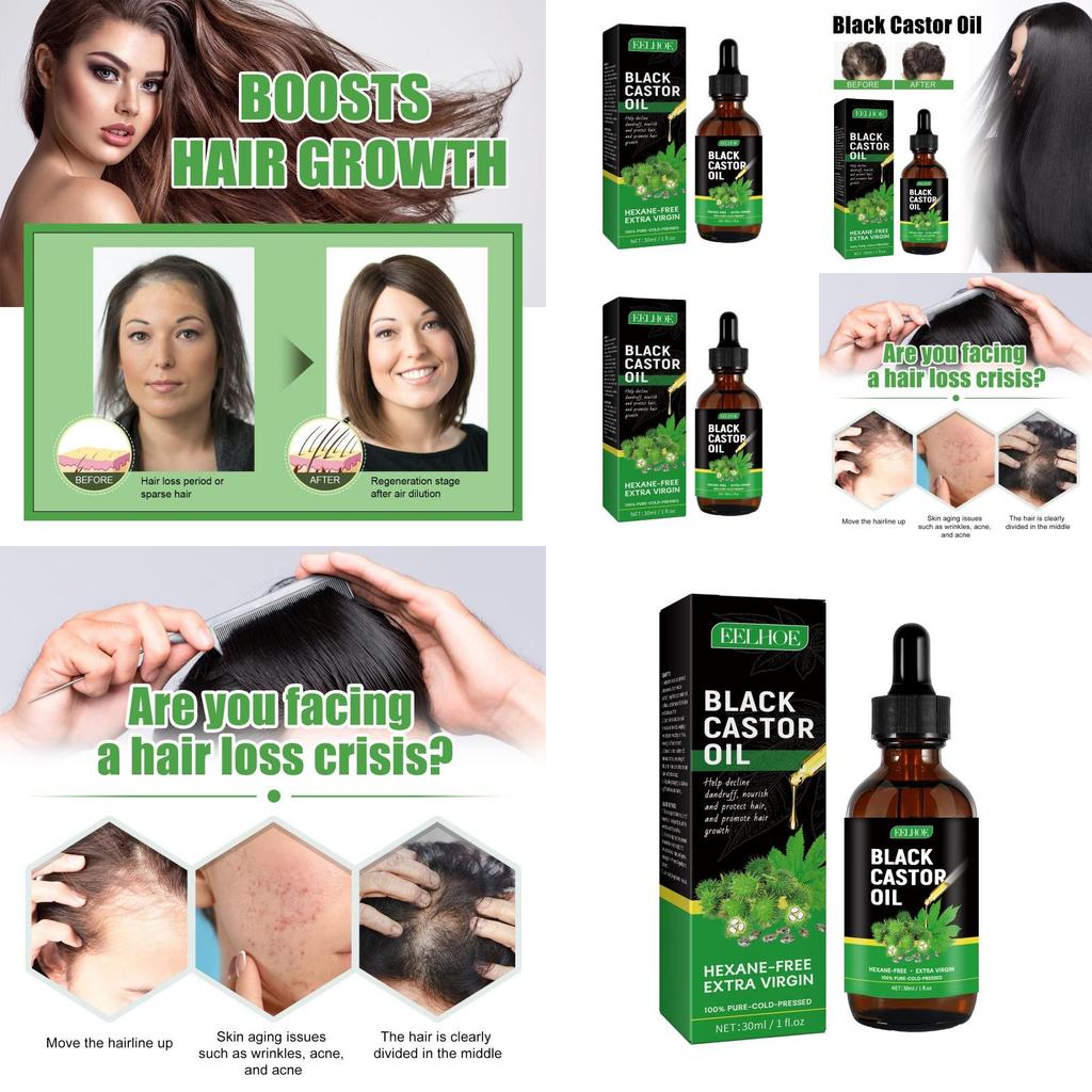 Eelhoe Castor Oil Hair Growth Serum Nourishing And Strengthening 30ml For Thicker Hair