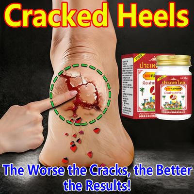 Special Soothing Cream for Dry and Cracked Skin Itching, Suitable for Skin Molting, Dry and Cracked