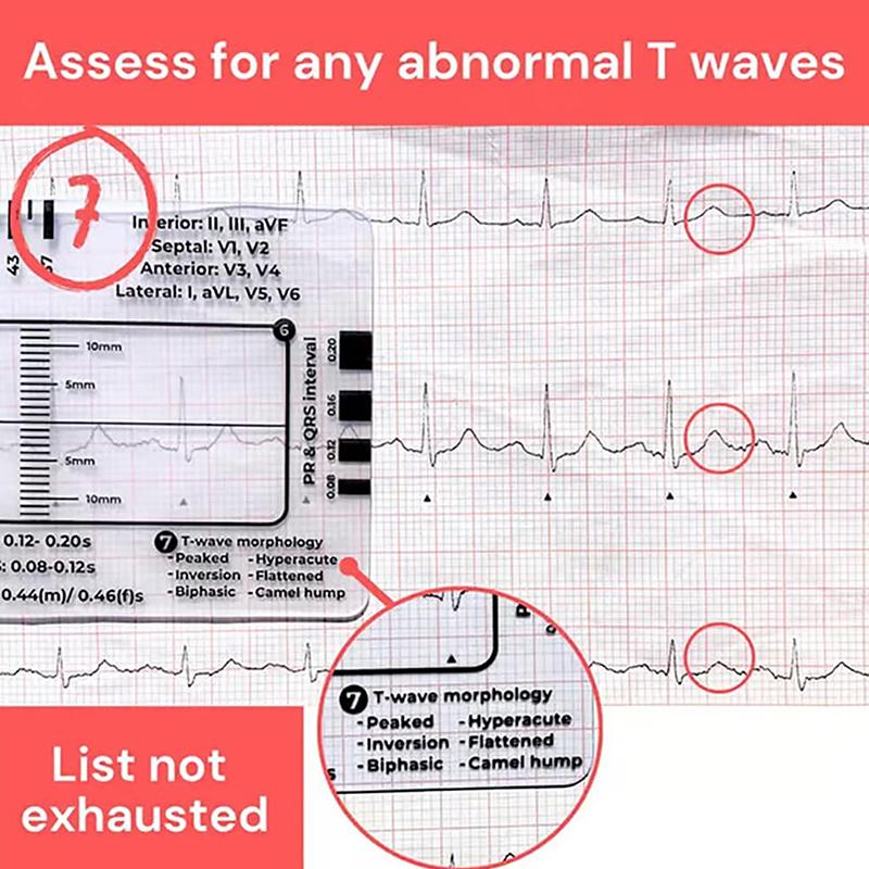 Ecg 7 Step Ruler Ecg Ruler Plastic Ruler Measuring Tool For Ecg/Ekg Interpretation Easy-To-Carry, With Protect Sheath