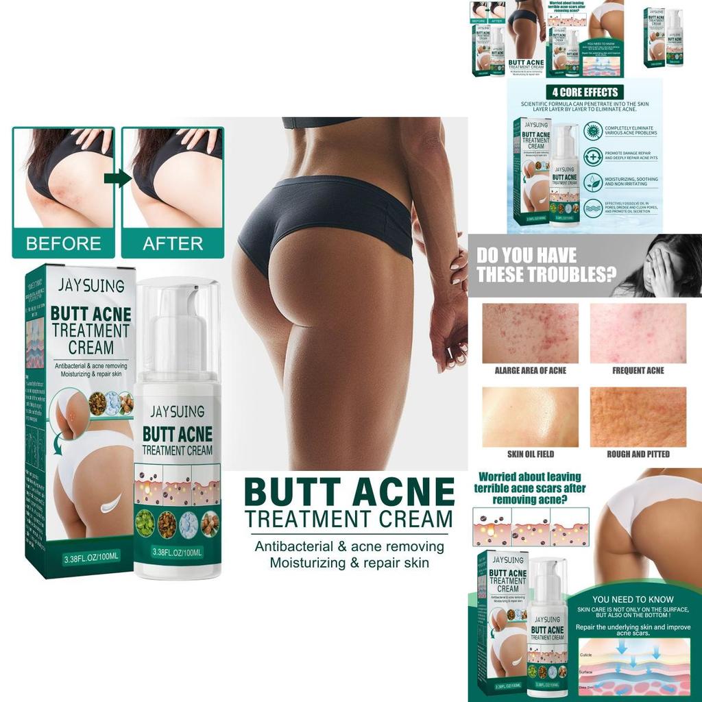 Jaysuing Butt Care Cream Nourishing Moisturizing Formula For Clear And Smooth Skin