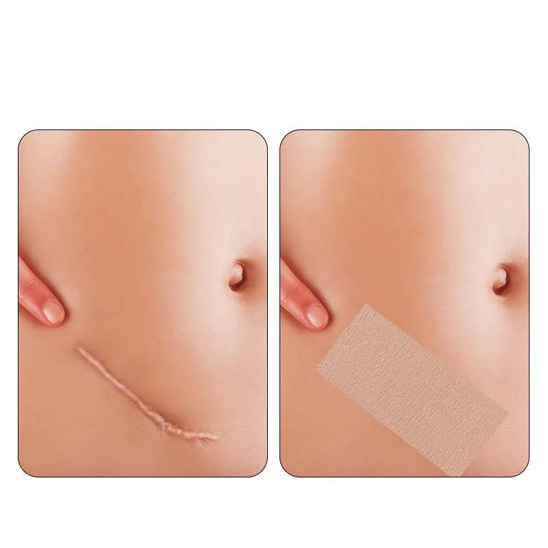 Invisible Skin Color Tattoo Patches Natural-Looking Birthmark Concealer for Arms Legs Back Post-Surgery Cover Up Hypoallergenic