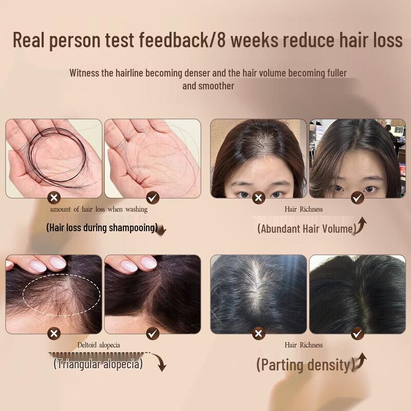 Three Magicians Ginger Anti-Hair Loss & Oil Control Shampoo