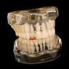 New Single and Double Flame Pattern Full Zircon Gold Teeth Halloween Hot Cosplay Versatile Dental Jewelry Braces Wholesale