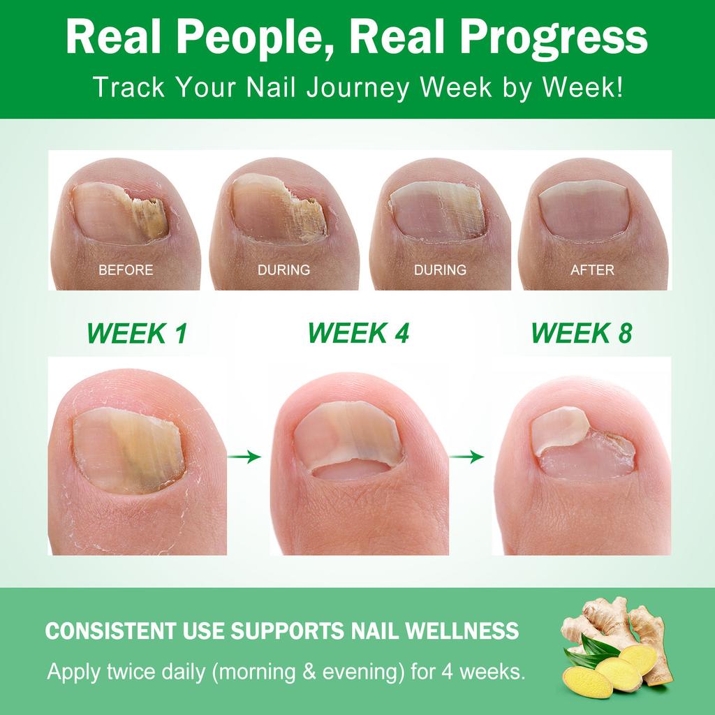 Nail Growth Serum  Nail Polishing Strengthening Nourishing Nail Serum 60ml