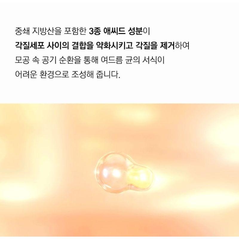 NATUREKIND Acne Deep Cleansing Foam 100ml