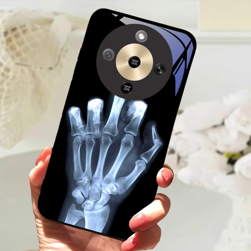 For Honor X9d 5G Case Fashion Painting Tempered Glass Shockproof Phone Case For Honor X9 D HonorX9D Back Cover Fundas Bumper