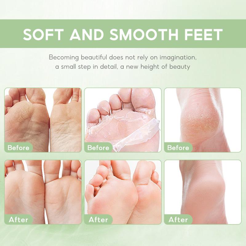 Crème pour les pieds au thé vert 30ml Lisse Délicate Éclatante et Translucide Absorption Rapide par la Peau Sérum Anti-Âge au Rétinol
