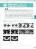 Cancer Interpretation Reports and Comprehensive Imaging Diagnosis Using PET