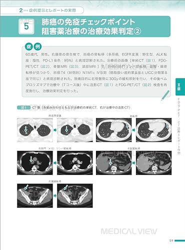 Cancer Interpretation Reports and Comprehensive Imaging Diagnosis Using PET