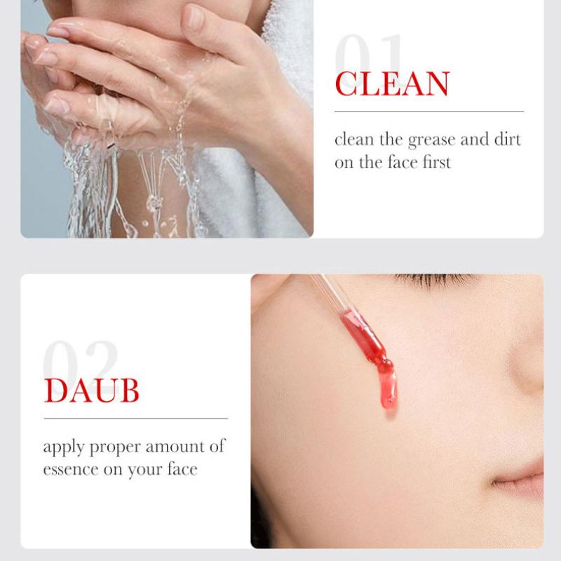 Acne Serum SADOER Fruit Acid Dilutes Acne Marks, Hydrates and Moisturizes