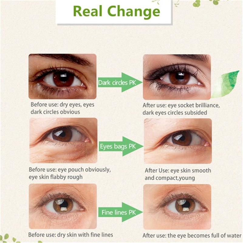 Red Ginseng Eye Cream Snail Essence Anti Aging Eye Cream Moisturizer