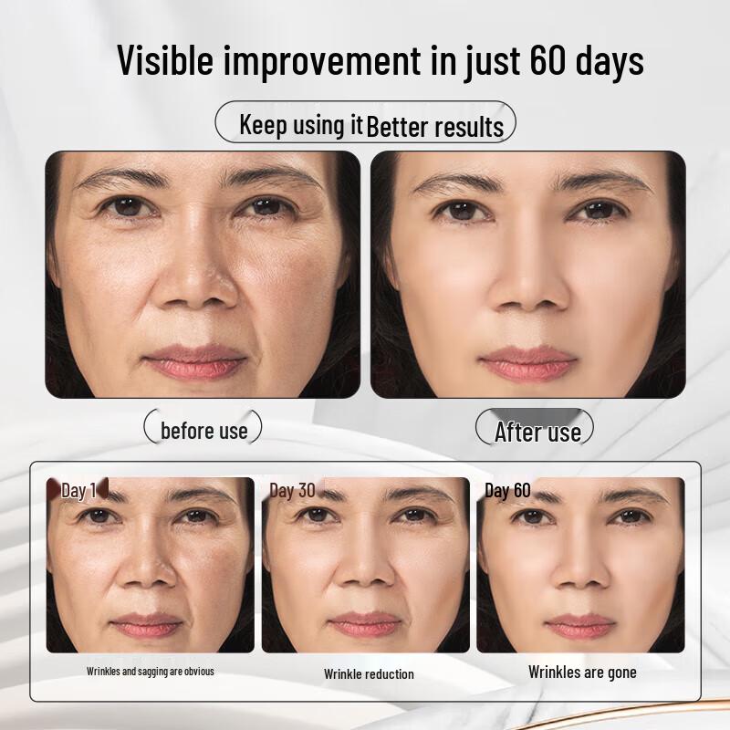 BEAUTY NOTES Black Bandage Anti-Wrinkle Firming Cream