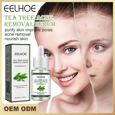 Tea Tree Anti-Acne Face Serum Oil Control Shrink Pores Acne Serum Anti Pimple Whitening Acne Scar Remove Skin Care Serum