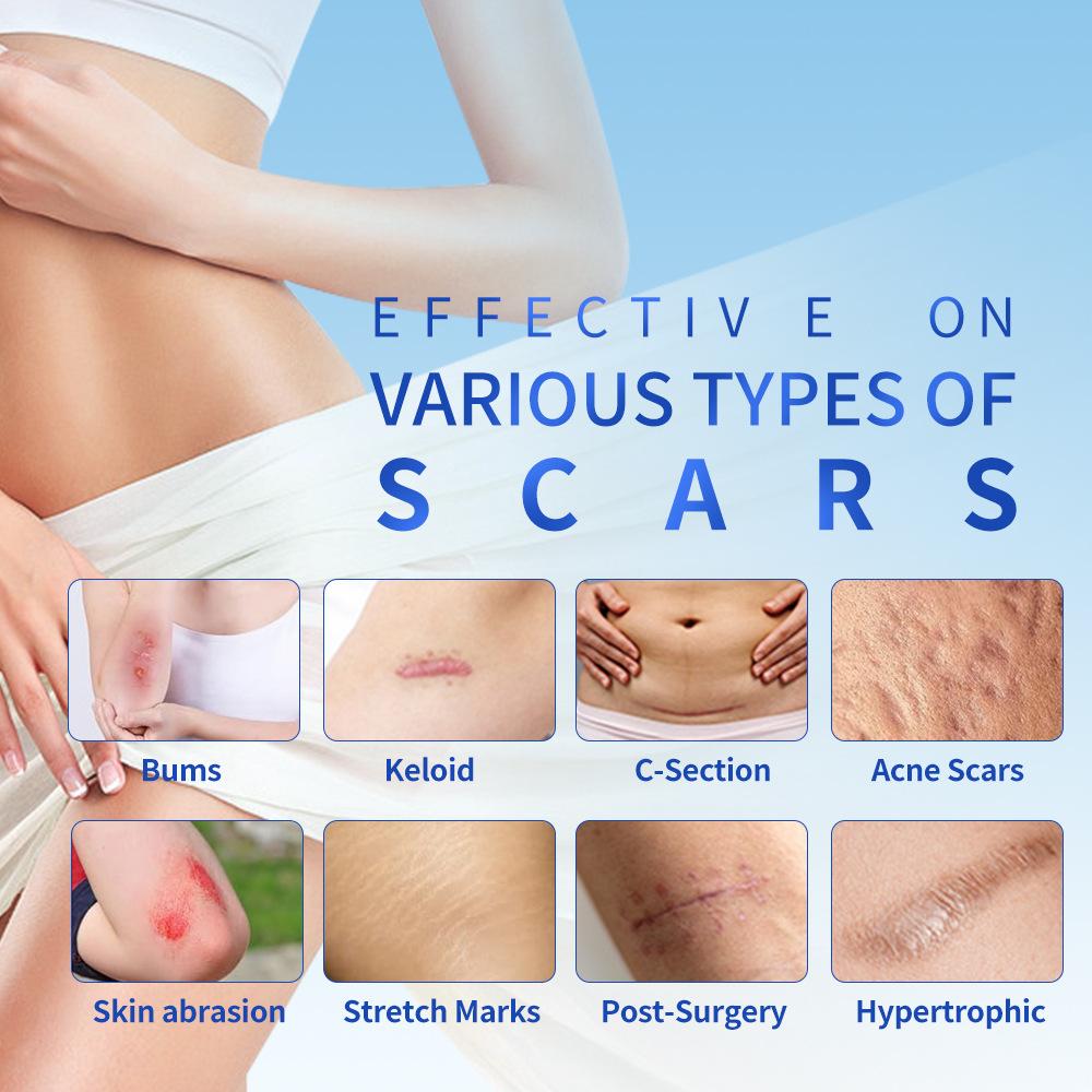 Invisible Scar Patch Transparent Scar Patch Scar Removal and Repair Patch  (40mm X 1.5m)