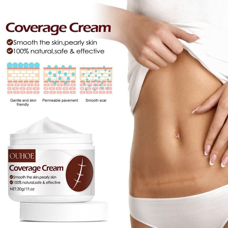 Ouhoe Scar Repair Cream For Effective Skin Scar Reduction And Healing Solutions