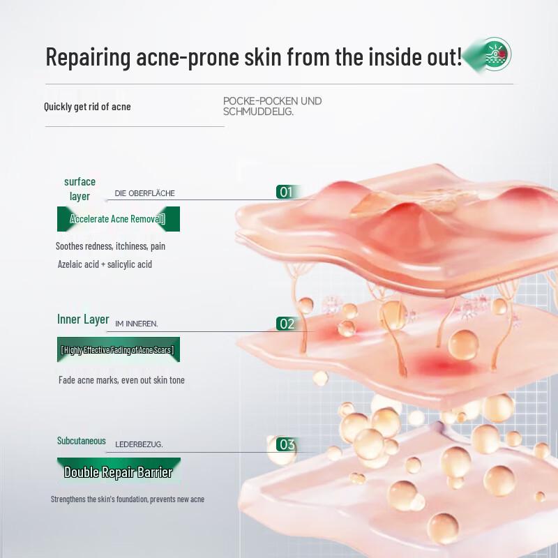 IMCAY Salicylic Acid Pore Refining Gel Cream