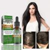 Eelhoe Hair Regenerating Essence 30ml, Scalp Care, Prevents Split Ends, Repairs Damaged Hair, 11x3x3cm