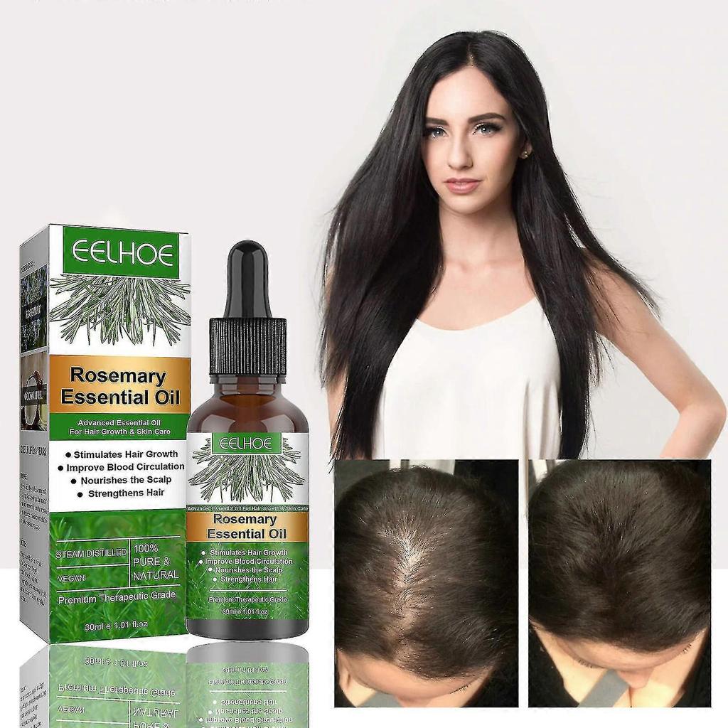 Eelhoe Hair Regenerating Essence 30ml, Scalp Care, Prevents Split Ends, Repairs Damaged Hair, 11x3x3cm
