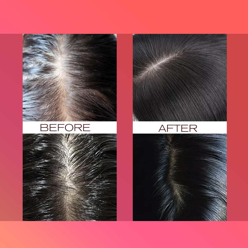 Batana & Rosemary Oil, Essential Oil, Deep Moisturizing for Men and Women for All Hair Types, Hair Serums