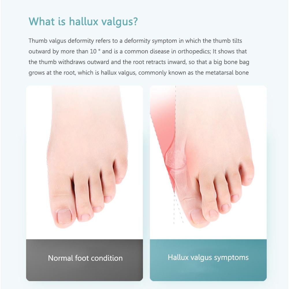Bunion Corrector Pedicure Bone Thumb Adjuster Foot Pain Relief Foot Finger Separator Orthopedic Feet Protector