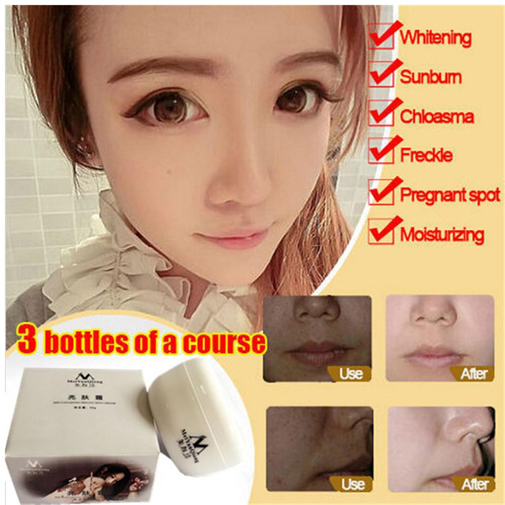 

Осветление Отбеливание Отбеливание Старение кожи Уход за лицом Удаление темного цвета белый