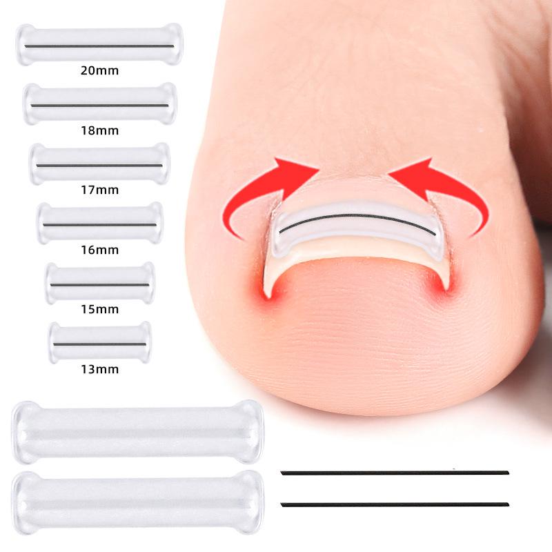 NiTi Alloy Bionic Toenail/Fingernail Corrector for Ingrown Nails