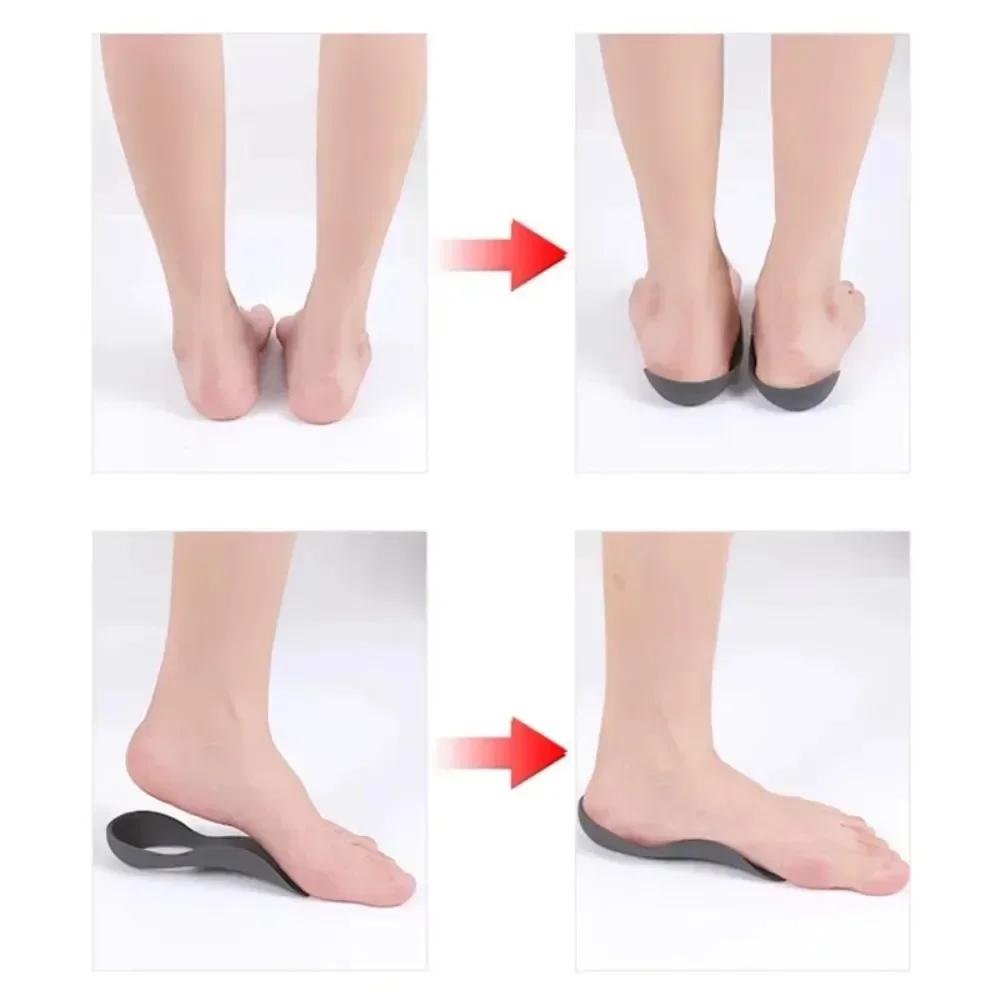 1 Pair Orthotic Insoles For Flat Feet O-Shaped Legs And Plantar Fasciitis - Unisex Arch Support Shoe Inserts
