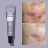 Acleon Youth Acne Skincare Ampoule & Spot Treatment Duo