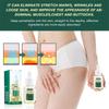 Slimming Body Essential Oil Anti Celulite Lift Firm Shaping Thin Leg Waist Belly Tummy Fat Burning Massage Weight Loss Product