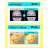 VT COSMETICS PDRN Tone On Line (5 Products / Full Set Available)