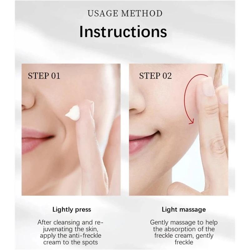 Whiten Cream Brighten Face Effective Remove Melasma Dark Spot Improve Dullness Skin Anti-pigmentation Care Cream Care Products