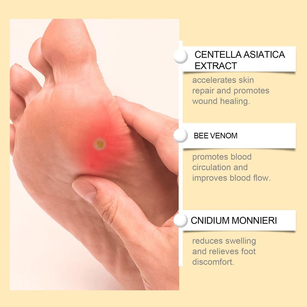 Bee Foot Spray Foot Care Spray For Swelling, Itching, Pain, Dryness And Moisturizing 20ML