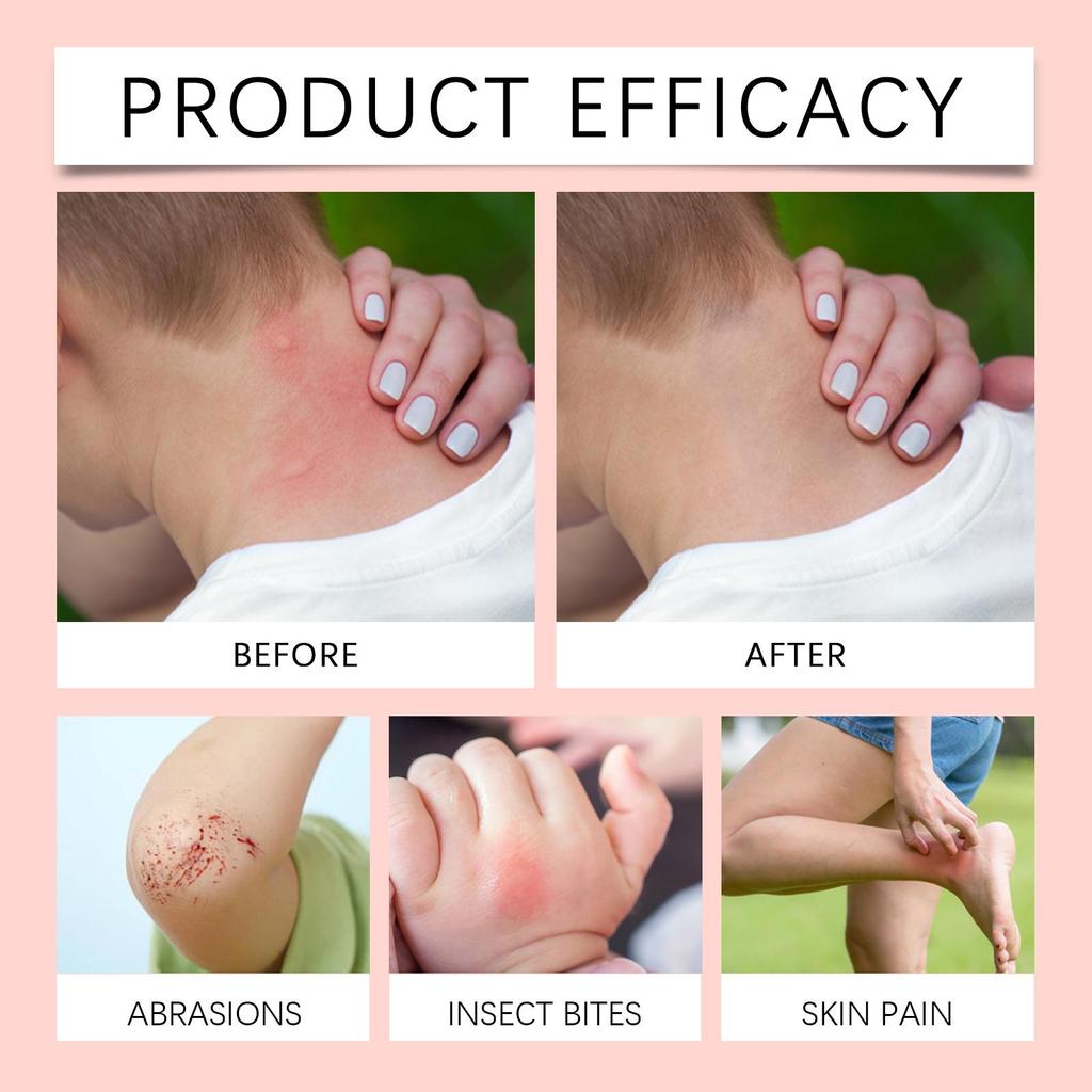 XIMONTH Hautpflegecreme Verbessert Hautbeschwerden Topische Anwendung Sanfte Feuchtigkeitspflege Haut Tägliche Pflegecreme