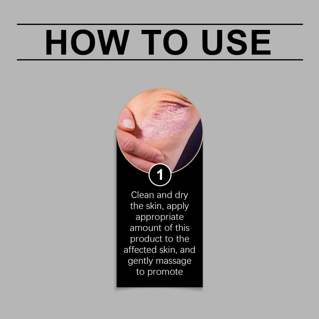 The Multi-functional Care Cream Relieves Eczema And Skin Inflammation, Deeply Moisturizes The Skin, And Promotes The Of The Skin Barrier