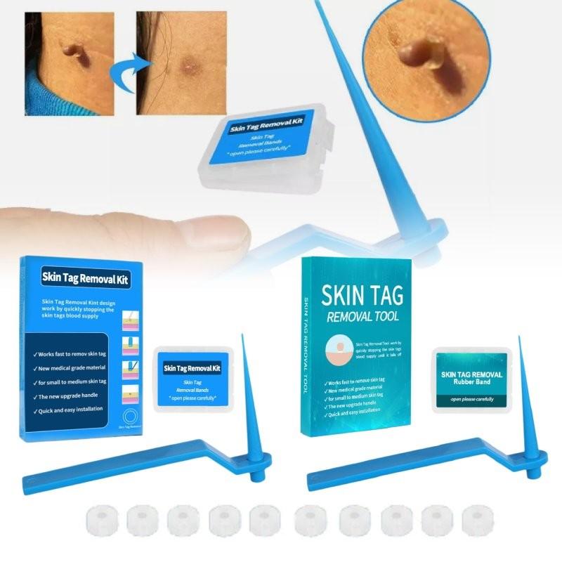 Effective Skin Tag Removal Tag Refill Band Set With 10 Pieces For Smooth Skin
