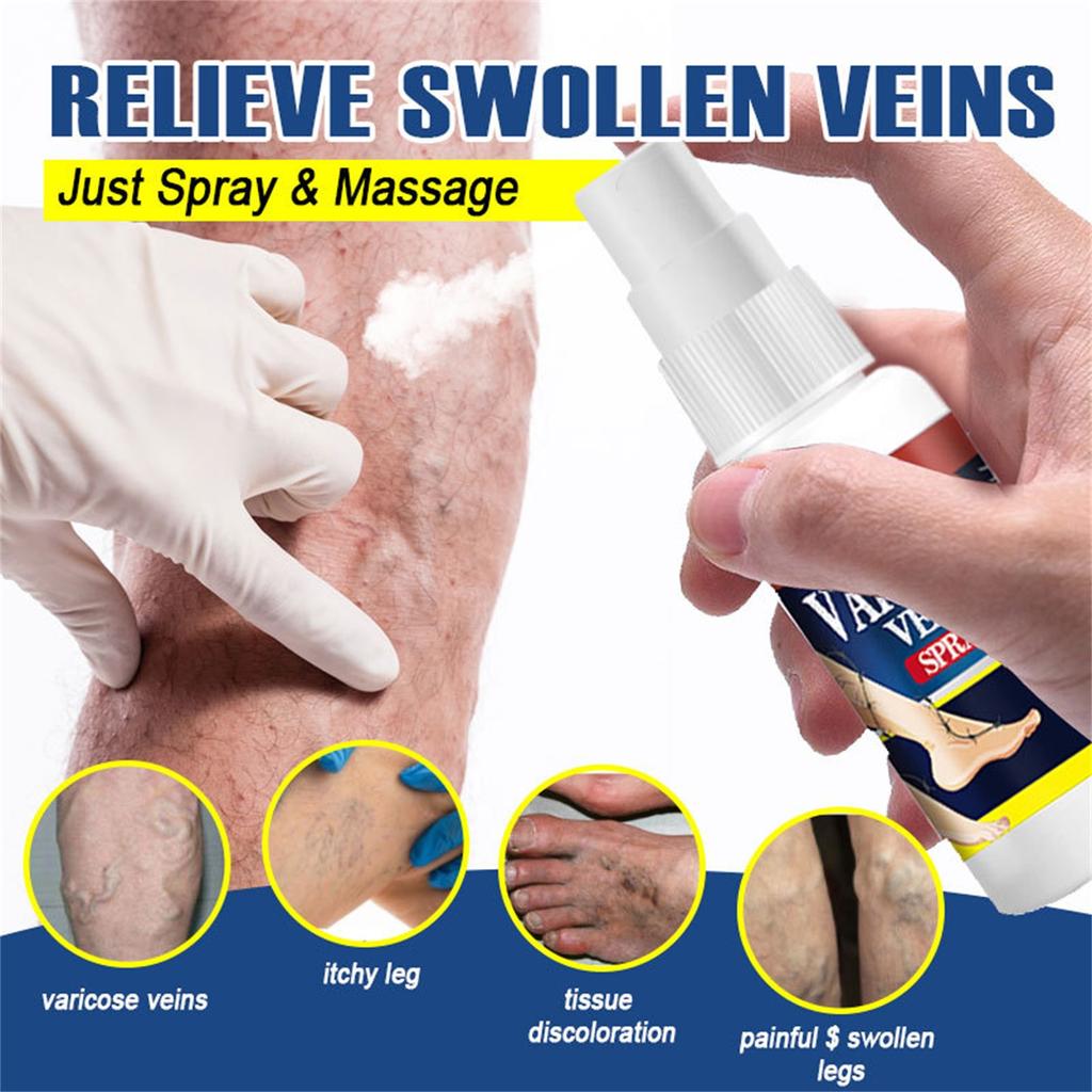 Vein Varicose Veins Spray, Vein Varicose Veins Spray, Vein Varicose Veins Spray 30ml