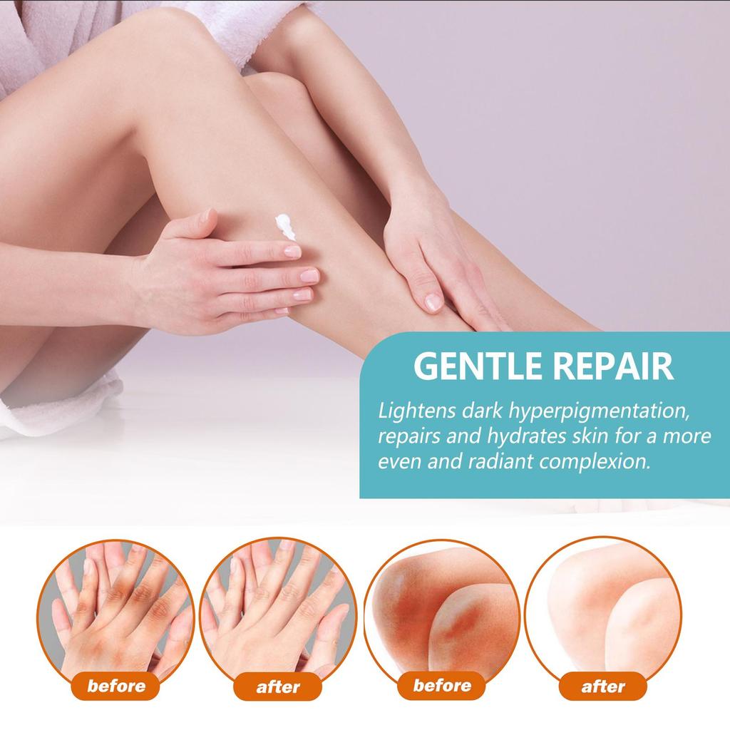 Spot Remover For Body,Spot Corrector Cream,- Underarm, Neck, Armpit, Knees, Elbows, Private Areas, Intimate Areas
