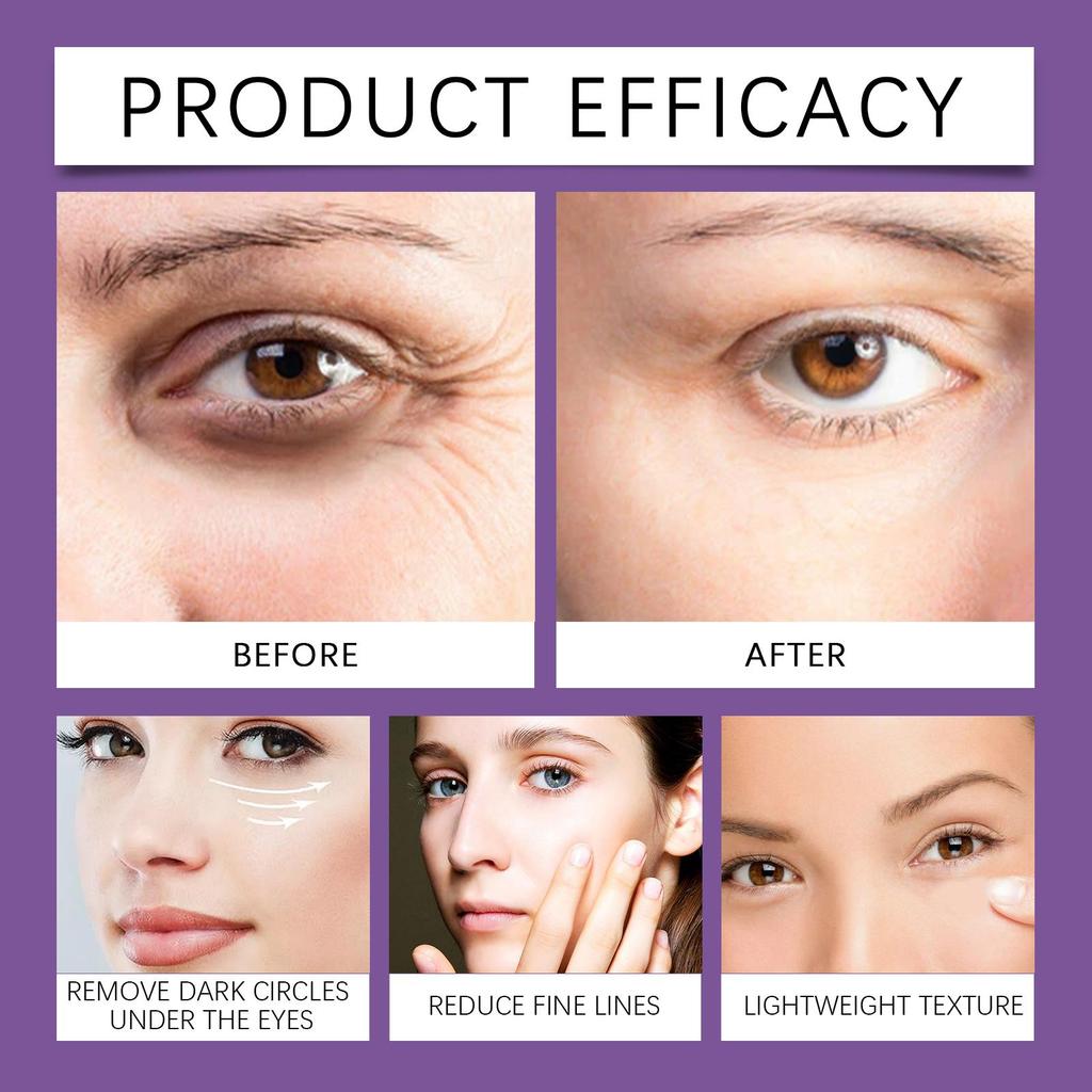 Hoygi eye essence moisturizes and gently reduces fine lines around the eyes, lifts the skin, eye massage care essence