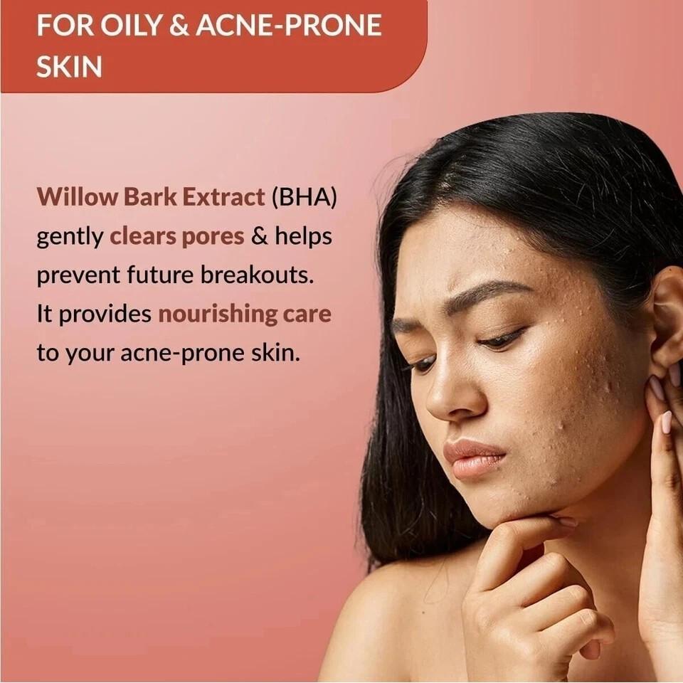 Fixderma Durave Acne Control & Oil Free Moisturizer for Face 50gm