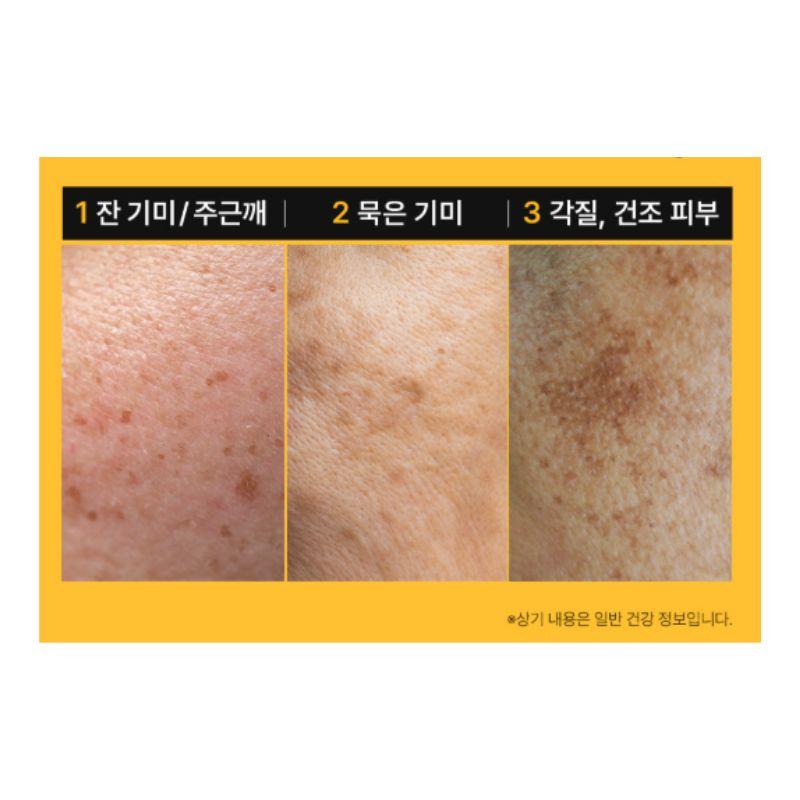 MEDI-PEEL Peptide 9 Vitanol Ampoule Pro 2 Week Dark Spot Care Brightening Peptide Serum 30ml