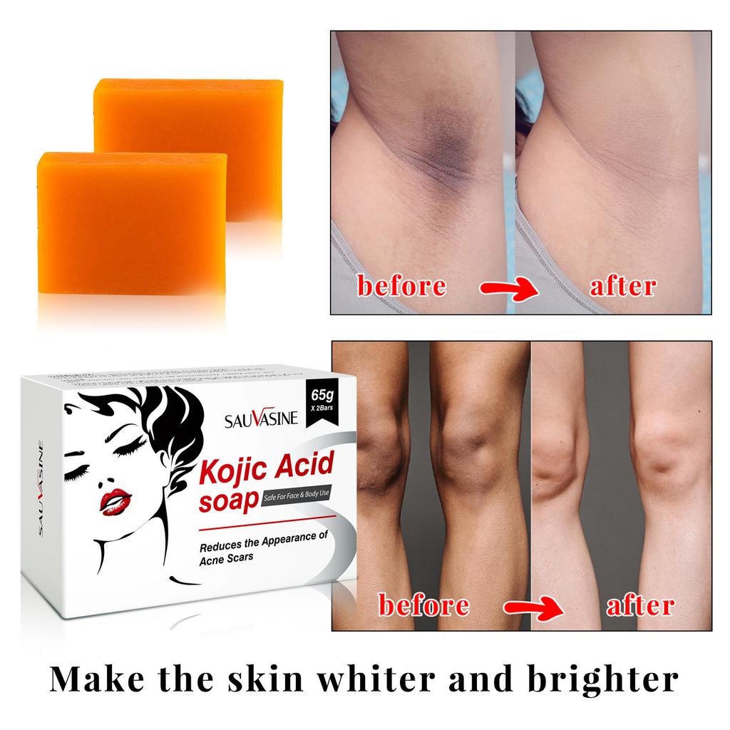 Kojic Acid Soap for Face and Body, Cleansing Bar for Rough Skin
