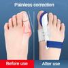 2Pcs Toe Separator Hallux Valgus Bunion Corrector Orthotics Feet Bone Straightener Adjuster Pain Relief Pedicure Foot Care Tool