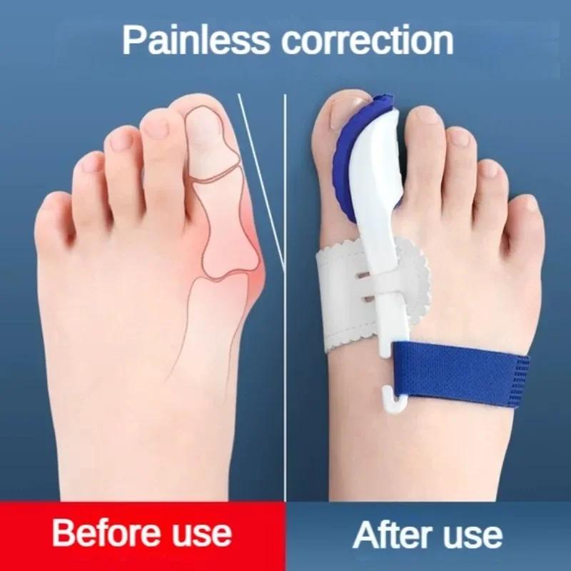 2Pcs Toe Separator Hallux Valgus Bunion Corrector Orthotics Feet Bone Straightener Adjuster Pain Relief Pedicure Foot Care Tool