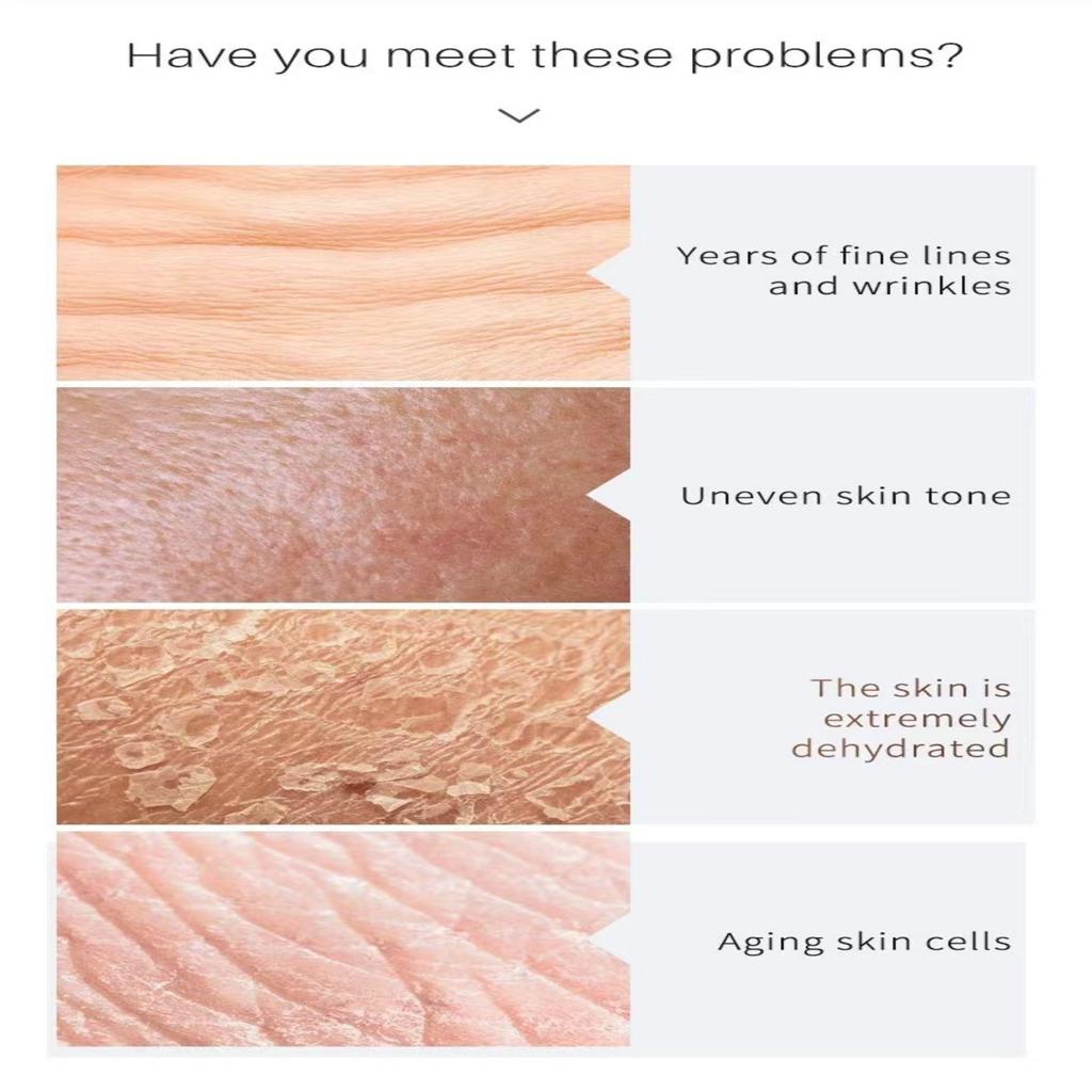 Vitamin C Cream Facial Hydration Vitamin hudblekingskrem for ansiktshudpleie hudpleie