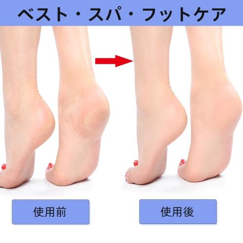 Heel Exfoliant, Heel Scraper, Glass, Foot Pumice Stone for Calluses and Calluses On Feet and Heels, 3-pack, Unisex