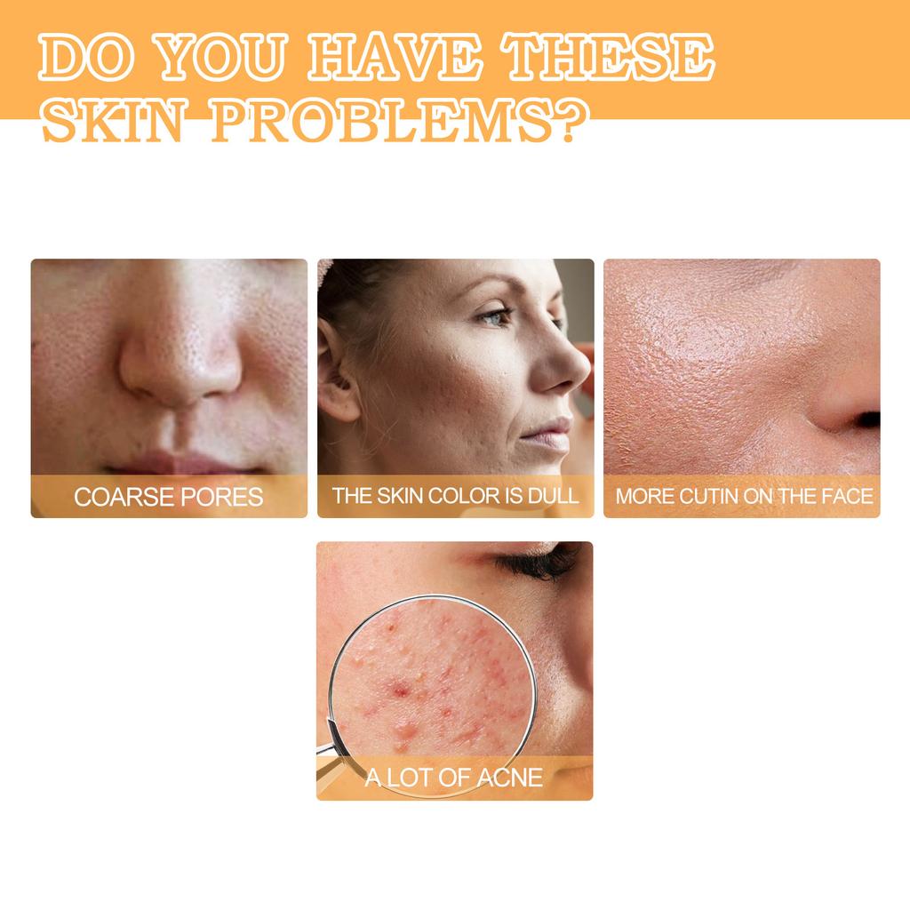 Glycolzuur 7% Toning Oplossing Exfoliërende Toner Poriënverkleiner Huid Egaliserend Verhelderend Gelijkmatige Toon Dagelijkse Gezichtsverzorging