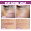 Ouhoe Scar Care Cream For Smoothing And Moisturizing Skin With Gentle Formula