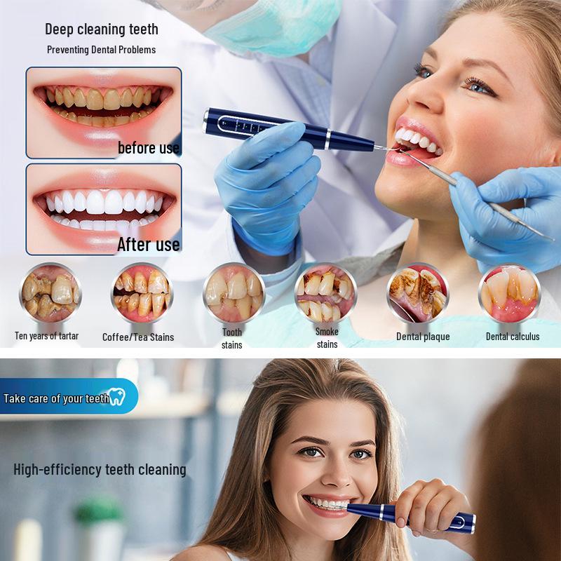 Elektrischer Ultraschall-Zahnreiniger: Zahnsteinentferner & Aufhellender Dental-Scaler