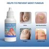 Ingrown Toenail Treatment Extra Strong,Ingrown Toenail Drop,Cuticle Care Oil for Ingrown Toenails Ingrown Toenail Tools